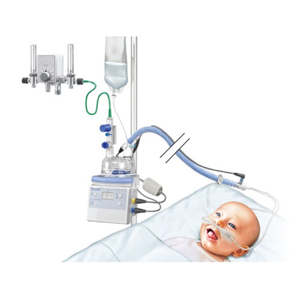 Bubble CPAP